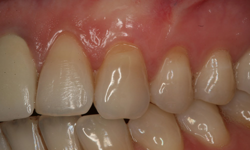 periodontologia poznań