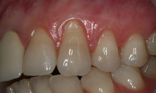 periodontolog poznań