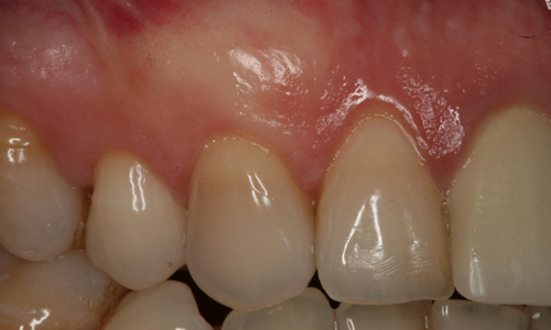 periodontologia poznań
