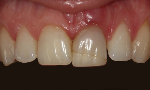 protetyka zębowa