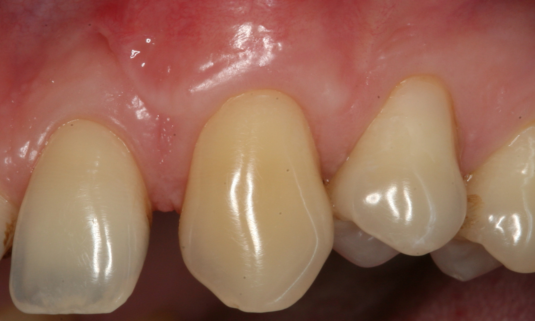 periodontolog poznań