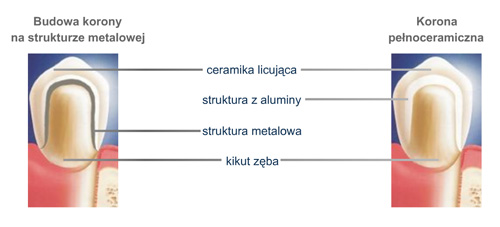 budowa korony zębowej